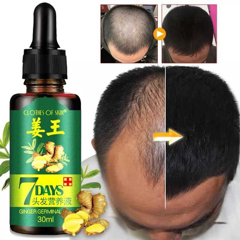 Hair growth, ginger, hair, nutrient solution, solidification, hair removal, anti-hair removal products